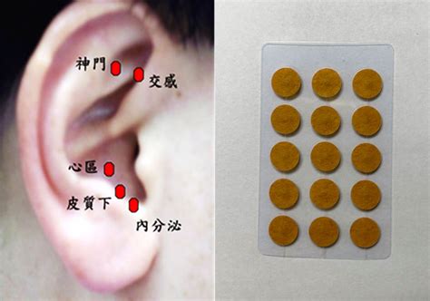 耳穴貼是什麼 中國靈異事件
